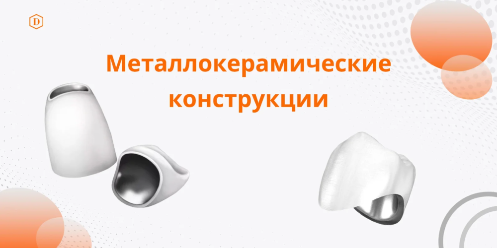 Металлокерамические конструкции