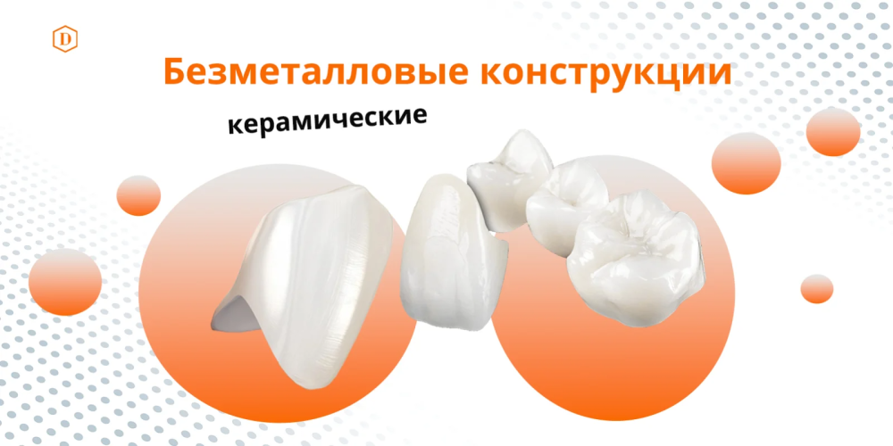 Безметалловая конструкция