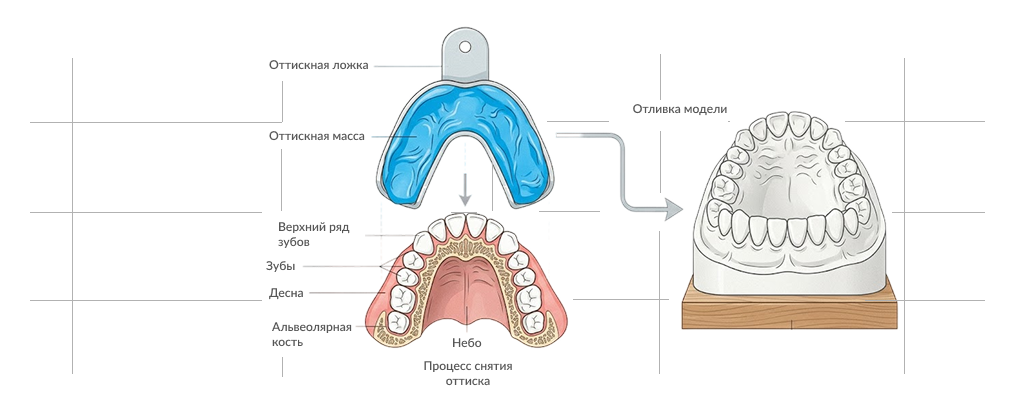 chto-nuzhno-znat-ob-ottisknykh-materialakh-ot-klassifikatsii-do-vybora-1024x400