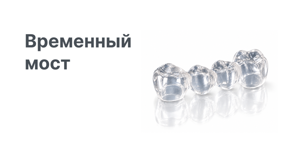 1160х560_Временный мост2.png