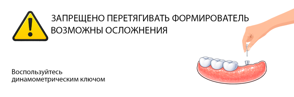 Gingival-formulator-and-its-retraction.png